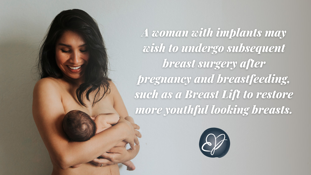 Successful Breastfeeding After Breast Implants! - Breastfeeding